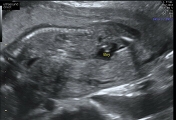Due October 2023 - thread 6