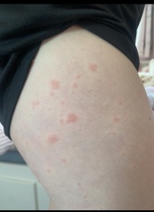 What could this rash be..? (Pics included)