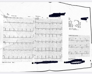 ECG results. Please help. 