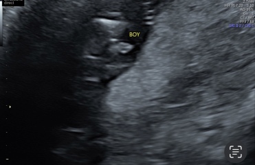 TWW - Testing Around 1st March 