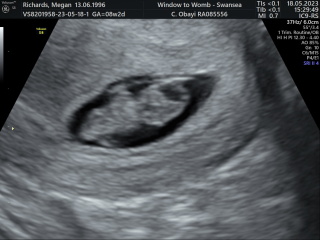 Due December 2023 part 3