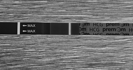 1DPO - Anyone want to wait with me ☺
