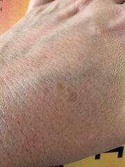 Just ageing hands or something to worry about?