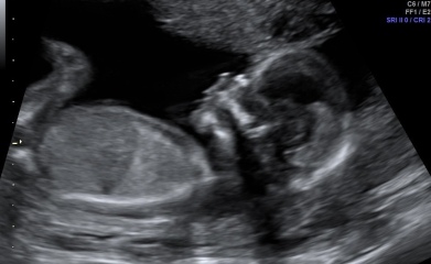 Gender guesses