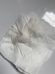 Implantation bleeding-help? TW photos 