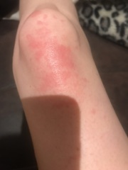 Does anyone know what this is?