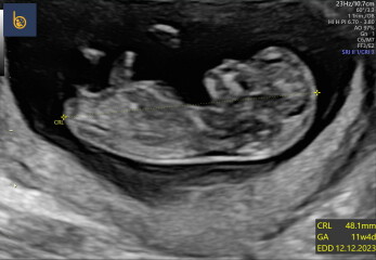 Gender guesses 