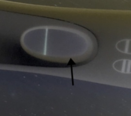 6dpo carry on thread number 2 