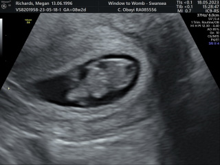 Due December 2023 part 3
