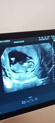 Can anyone guess? 12 week scan