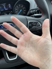 What are these weird spots on my hands? 