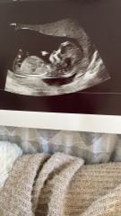 Due November 2023 Part 3