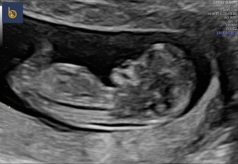 Gender guesses 