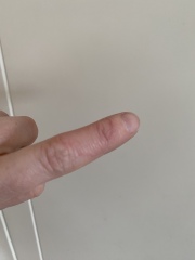 What is this on my finger? 