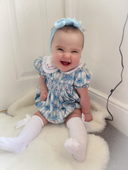 Mass on brain 4 month old baby