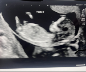 Gender (skull theory?) 