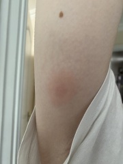 Odd lumps