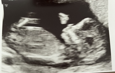 Boy or girl 