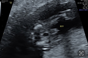 TWW - Testing Around 1st March 