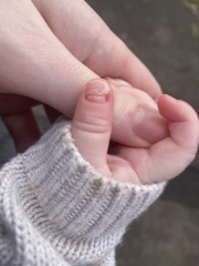 Baby finger nail coming off 