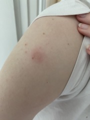 Odd lumps