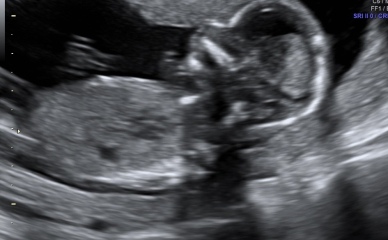 Gender guesses