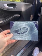 Terrified for my 8 week scan 