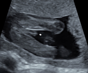 TWW - Testing Around 1st March 