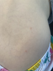 Spots 