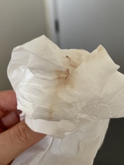 Potential miscarriage with bleeding 6 weeks