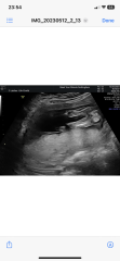 What do people think baby is 