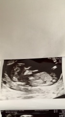 12wk + 6days. Girl or boy?
