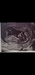 Girl or boy 
