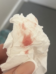 Potential miscarriage with bleeding 6 weeks