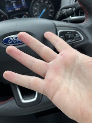 What are these weird spots on my hands? 