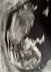 Boy or girl? 🥰