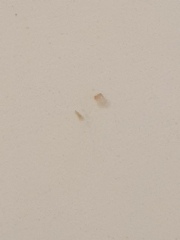 Is this what happens to warts?