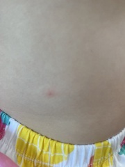 Spots 