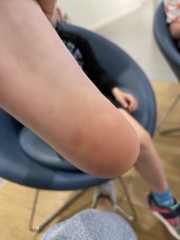 Any idea what these spots are? 