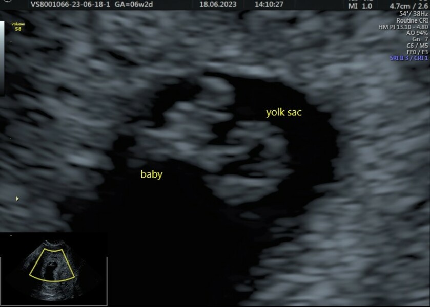 Due February 2024!
