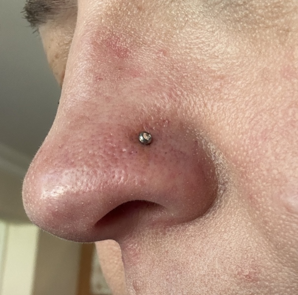 Nose piercing at 45?