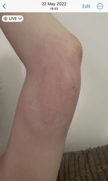 to think that mosquitos should not be a thing in the UK?