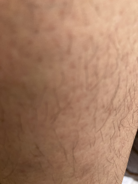 Is excessive body hair revolting?
