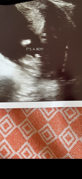 Private gender scans