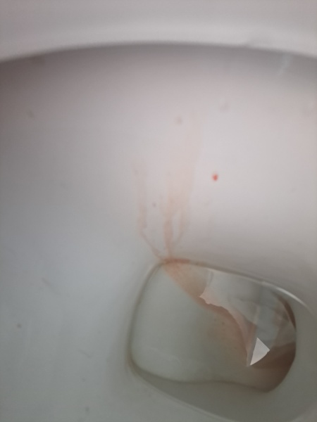 Implantation bleeding.