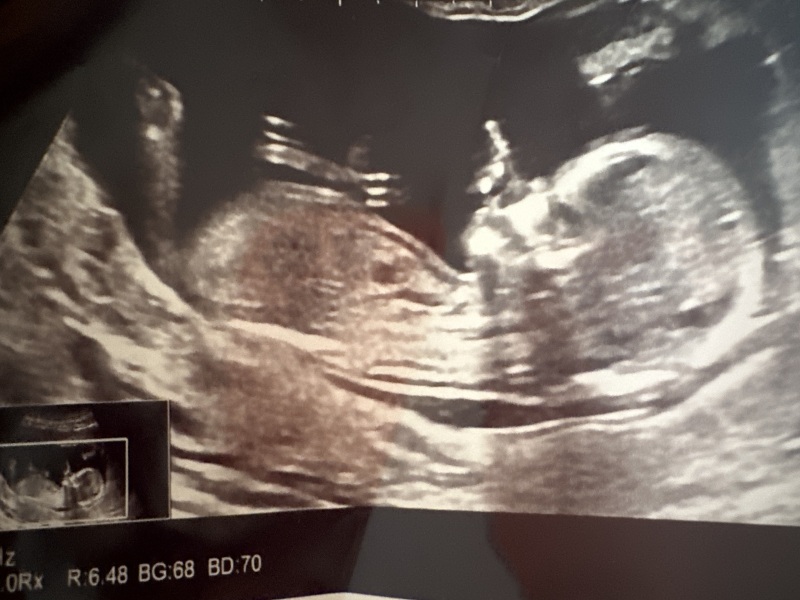 Gender guess