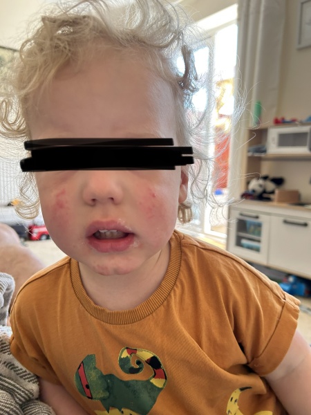 Doctors don’t know what’s wrong with DS’s face. Can the MN hive mind help?