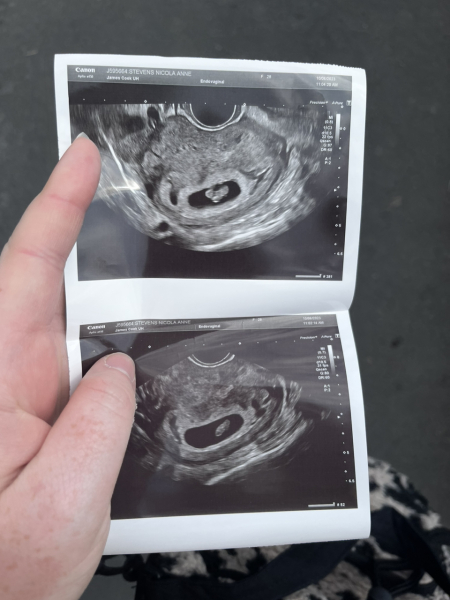 Pregant after miscarriage - support thread