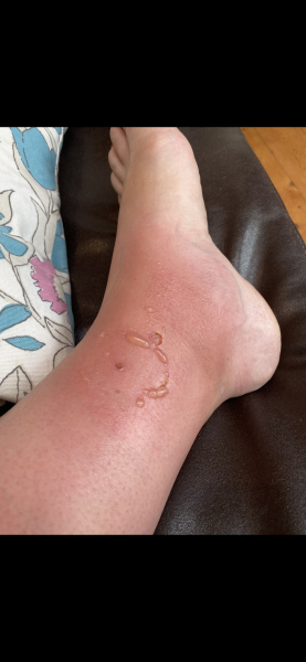 to think that mosquitos should not be a thing in the UK?