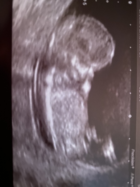 Due January 2024 🎉 PART 3